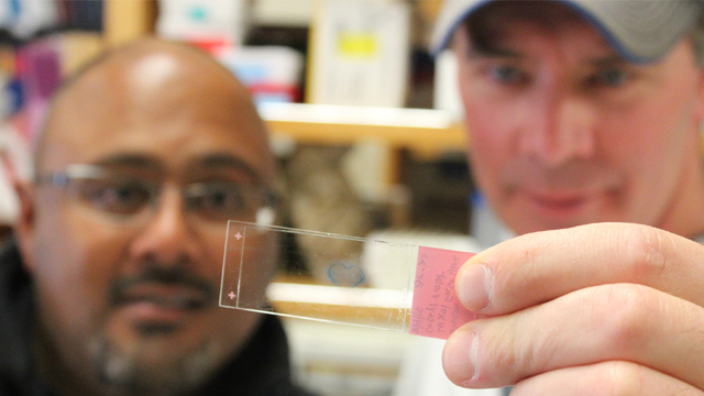 Dr. Sarj Patel and Dr. Tom Rau examine a slide from their research on traumatic brain injuries.